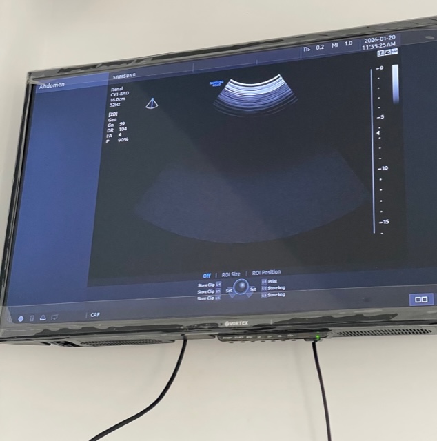 Monitor secundar pentru vizualizarea ecografiei în timp real, generând încredere și transparență în diagnosticul renal la Dr. Pușlenghea Raluca.